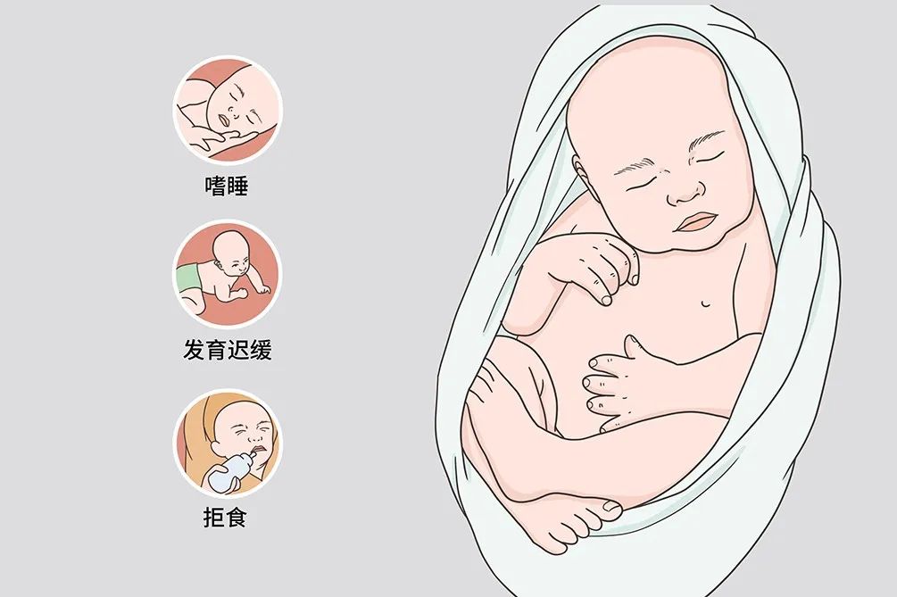 科普 | 出生缺陷三级预防——新生儿疾病筛查