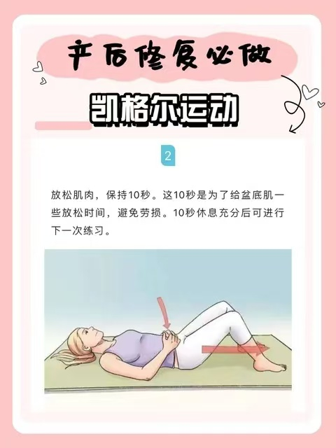 科普｜产后修复必备——凯格尔运动科普指南