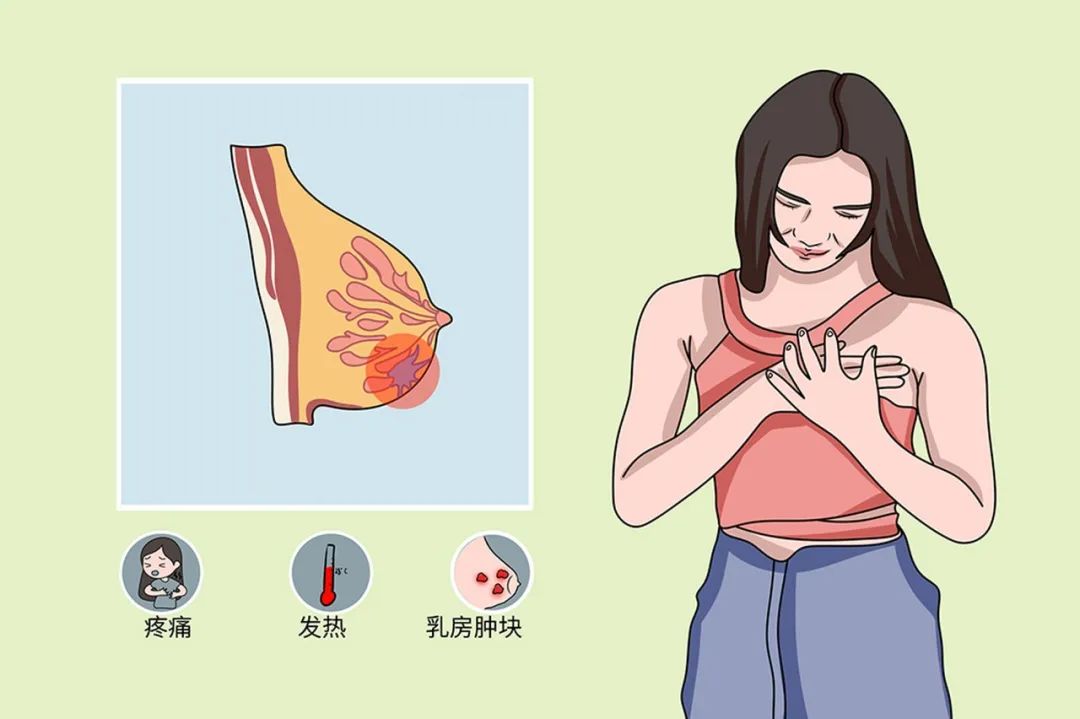 科普 | 警惕乳腺癌！这些要点你必须知道