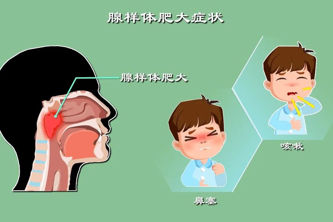 科普 | 宝宝要是打呼噜，爸爸赶紧掐烟头
